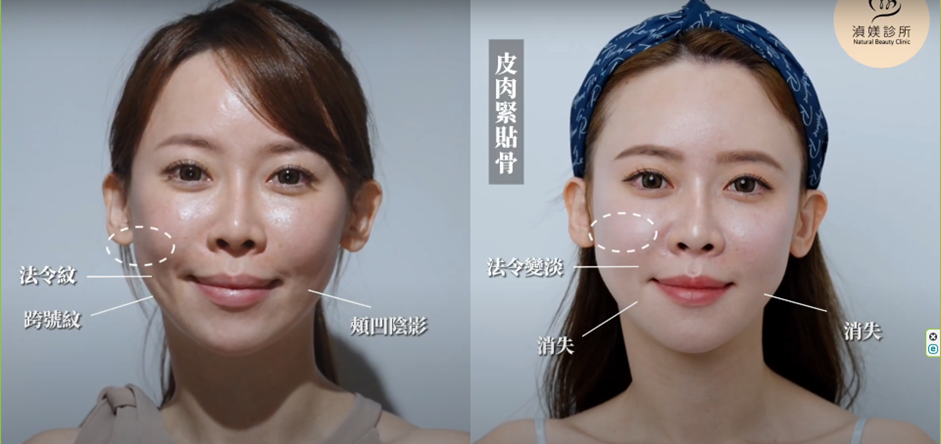影片中的時拍案例對比